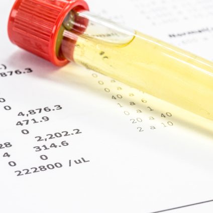 Rinnovabili • microplastiche nelle urine